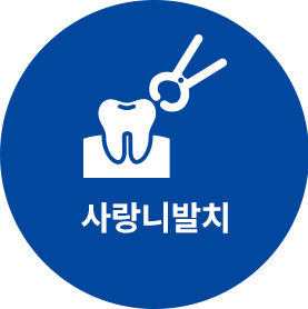 사랑니 발치