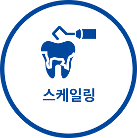 스케일링